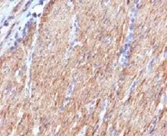 SMMHC / MYH11 Antibody (clone SMM11-1)