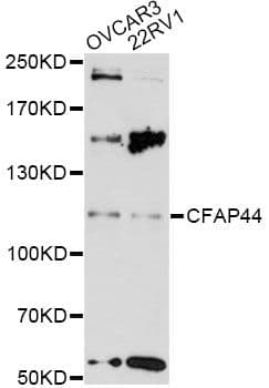 CFAP44 / WDR52 Antibody