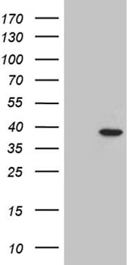 RHNO1 / C12orf32 Antibody (clone OTI2C12)