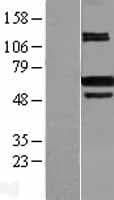 PRMT4 / CARM1 Protein (Over-Expression Lysate Myc-DDK (Flag))