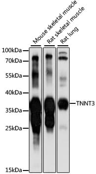 Polyclonal Rabbit anti-Human TNNT3 Antibody (WB)