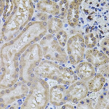ALDH1A1 / ALDH1 Antibody