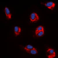 ANGPT1 / Angiopoietin-1 Antibody (Internal)