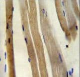Polyclonal Rabbit anti-Human CS / Citrate Synthase Antibody (aa27-55, IHC, WB)