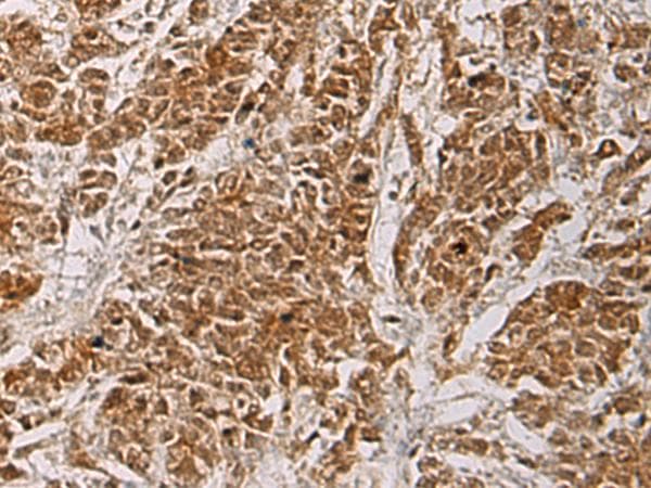 Polyclonal Rabbit anti-Human HOXC5 Antibody (IHC)