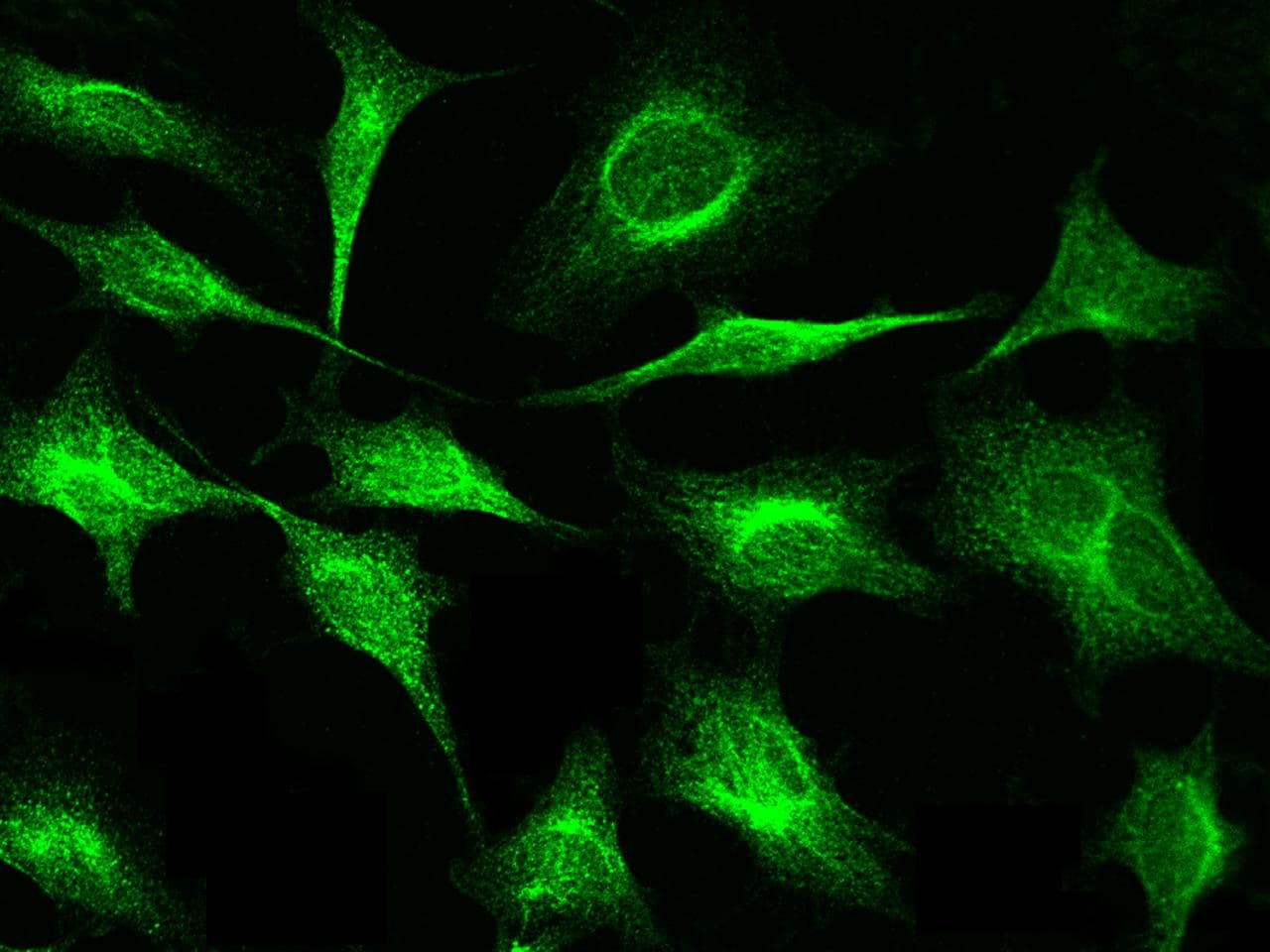 Polyclonal Rabbit anti-Human PFN1 / Profilin 1 Antibody (Preservative Free, IF, WB)