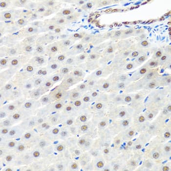 PRPF19 / PRP19 Antibody