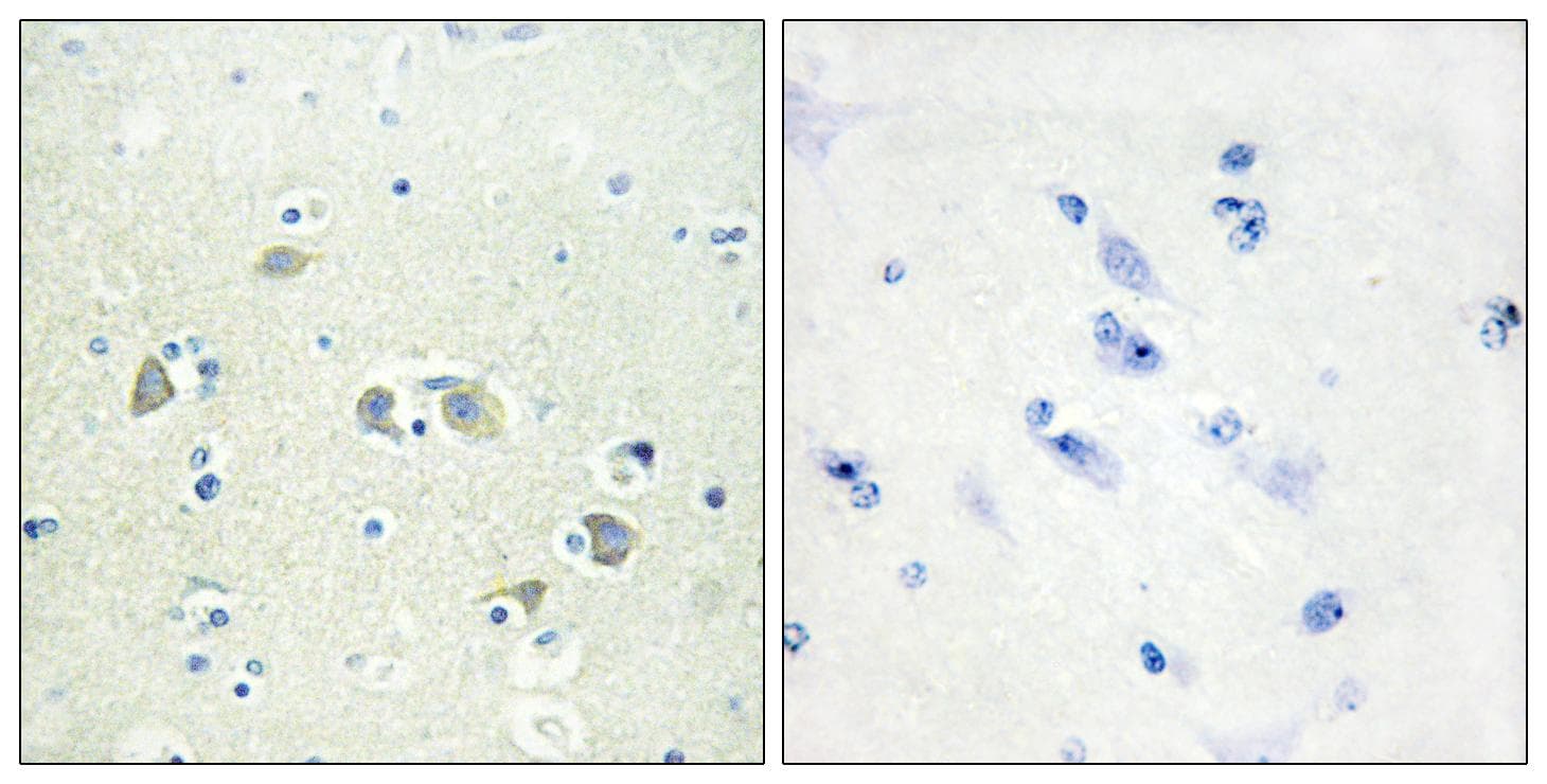 GAS6 Antibody