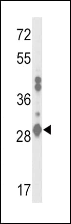 Polyclonal Rabbit anti-Human GSTA2 Antibody (aa1-30, IHC, WB)