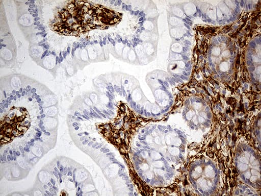 Monoclonal Mouse anti-Human MRC2 / Endo180 Antibody (clone OTI9G4, IHC, WB)