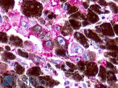 PathPlus™ RAIG2 / GPRC5B Antibody (C-Terminus)