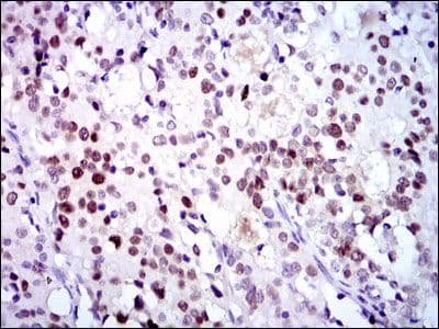 Monoclonal Mouse anti-Human CDK2 Antibody (clone 1A6, IHC, IF, WB)