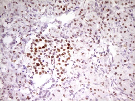 Monoclonal Mouse anti-Human MEF2D Antibody (clone OTI1E11, aa1-282, IHC, WB)
