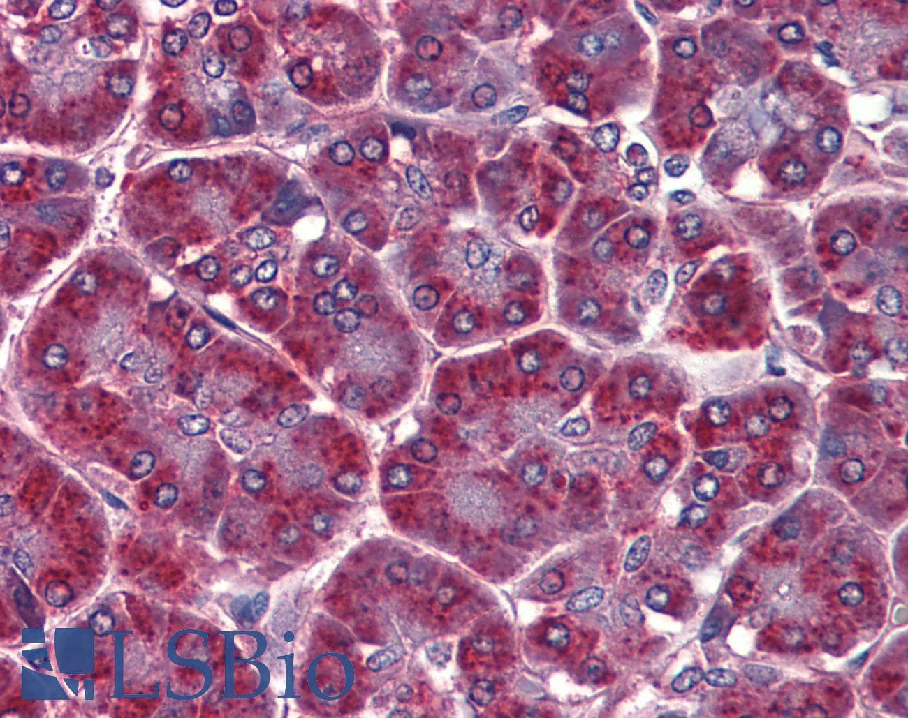 IHC-plus™ ALDH3A1 Antibody