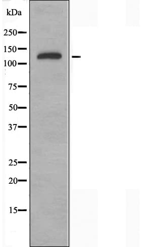 ATXN2 / SCA2 / Ataxin-2 Antibody