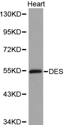 DES / Desmin Antibody