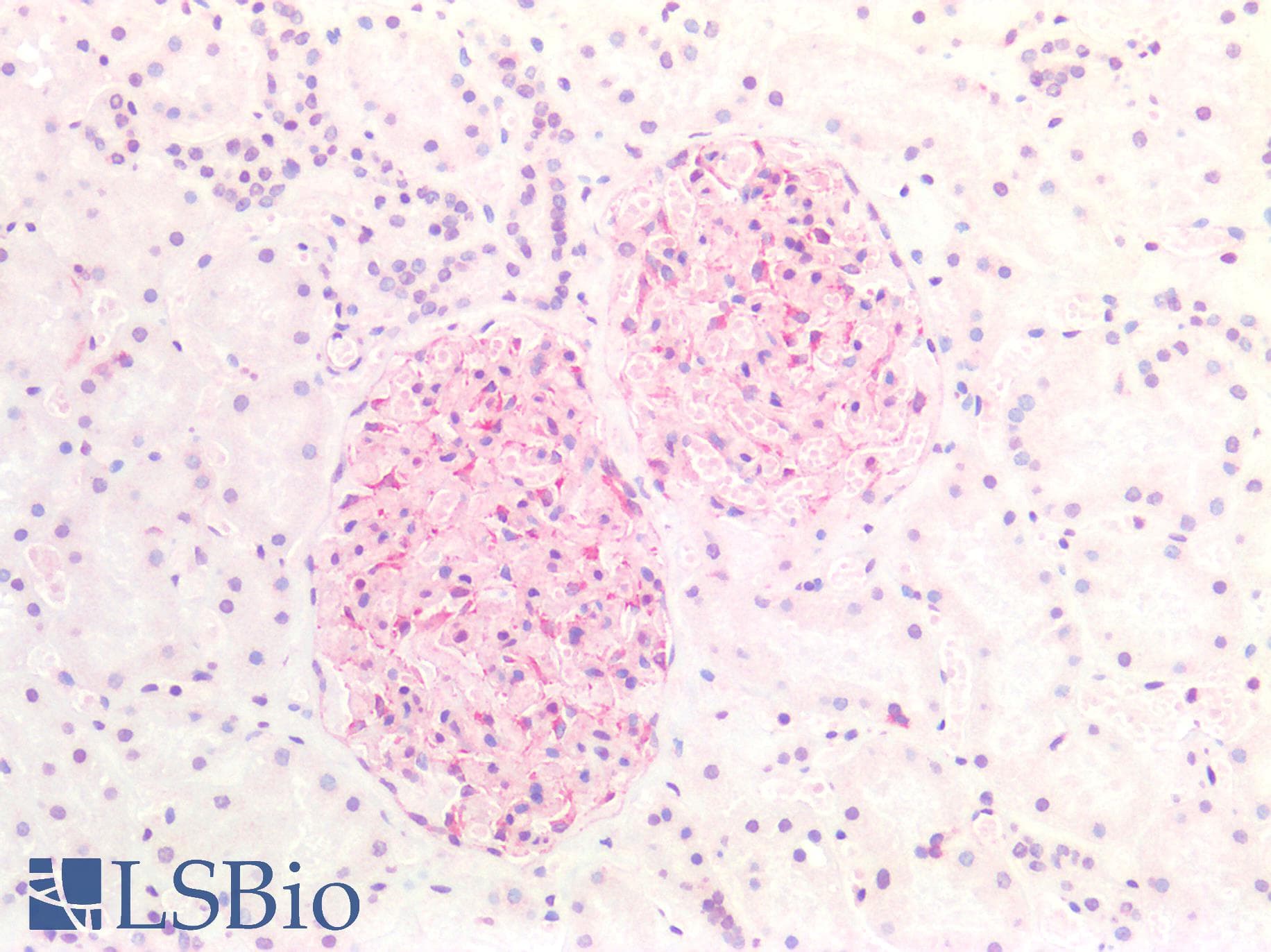 PathPlus™ Vimentin Antibody (clone RV202)