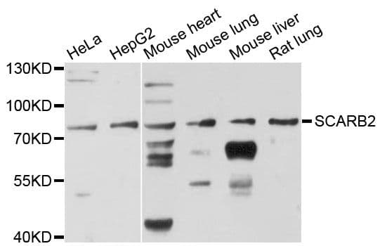 LIMPII / SCARB2 Antibody
