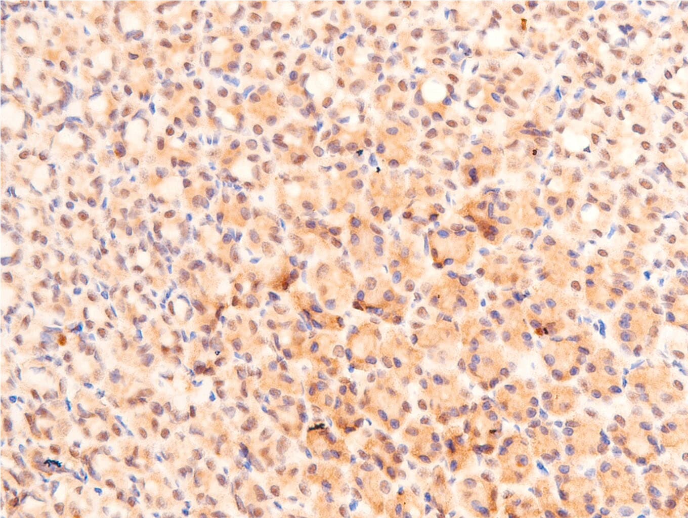 TP53 / p53 Antibody (Acetyl-Lys317)