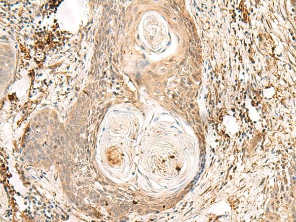 ZNF397 Antibody