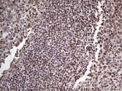 Monoclonal Mouse anti-Human C14orf166 Antibody (clone OTI4A3, IHC, WB)