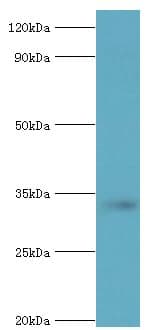 Polyclonal Rabbit anti-Human STOM / Stomatin Antibody (aa55-288, IHC, WB)