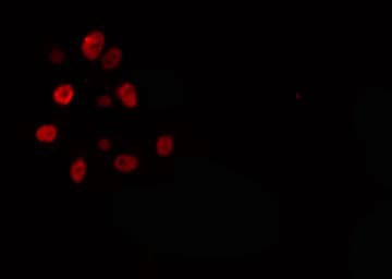 ELL / MEN Antibody