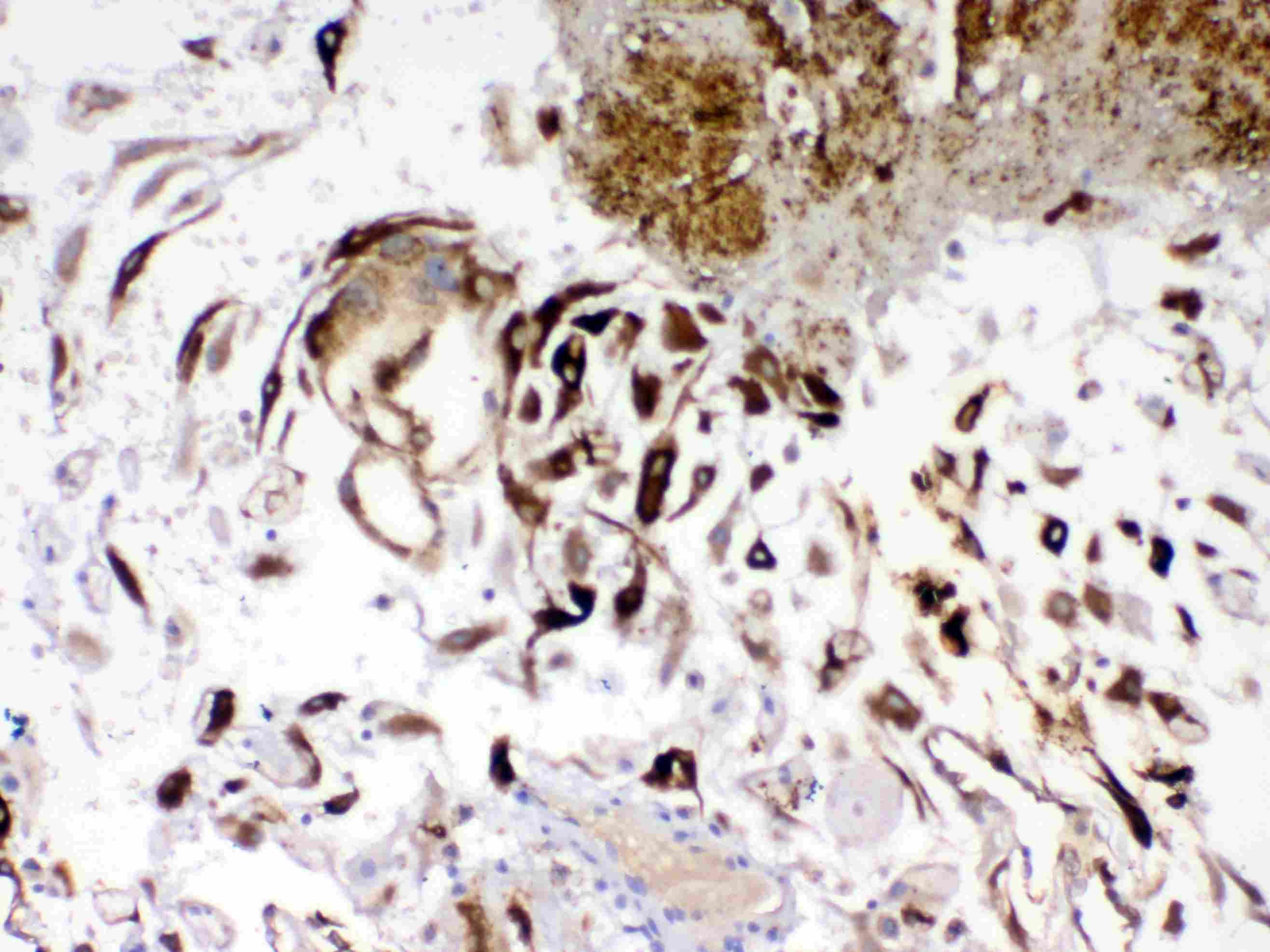 Polyclonal Rabbit anti-Human IGFBP1 Antibody (IHC, WB)