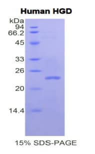 Human HGD Protein (Recombinant His)