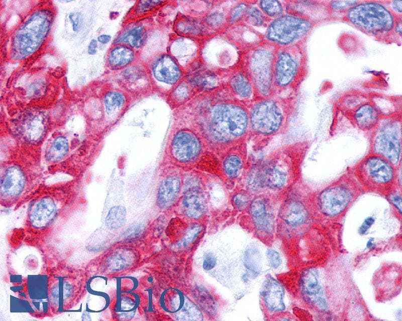 PathPlus™ Polyclonal Rabbit anti-Human GPBAR1 / TGR5 Antibody (C-Terminus, IHC)