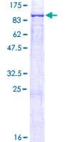 Human ALOX12B Protein (Recombinant GST)