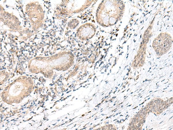 GANC Antibody