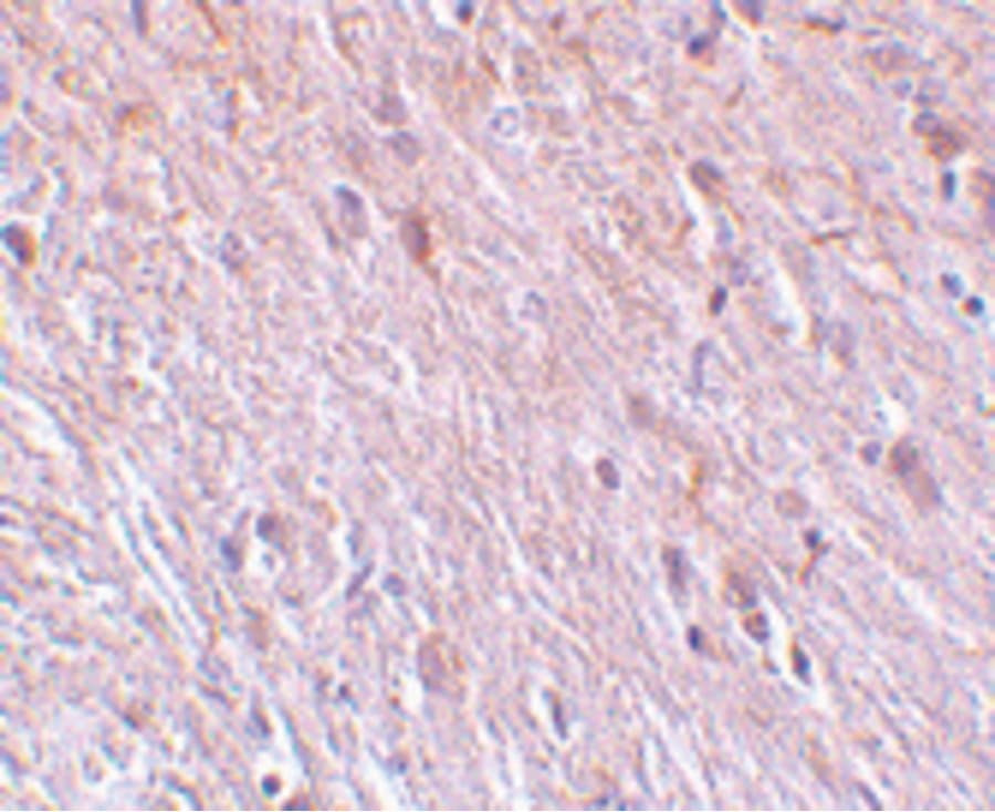 Polyclonal Rabbit anti-Human TTC5 Antibody (IHC, IF, WB)