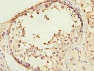 COPS3 / CSN3 Antibody