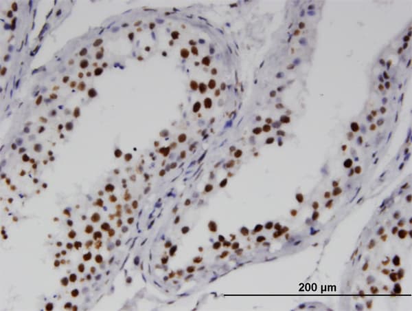 Monoclonal Mouse anti-Human RNF25 Antibody (clone 1D10, IHC, WB)