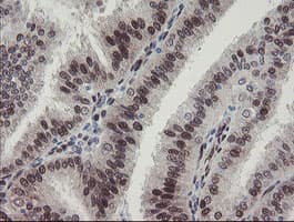 RBPMS / Hermes Antibody (clone OTI3B7)