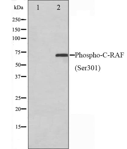 RAF1 / RAF Antibody (phospho-Ser301)