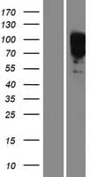 EYA1 Protein (Over-Expression Lysate Myc-DDK (Flag))
