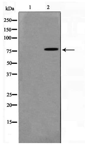 TGM2 / Transglutaminase 2 Antibody
