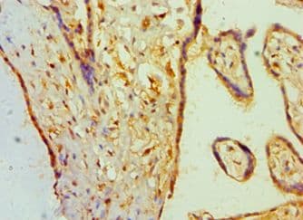 Polyclonal Rabbit anti-Human BAMBI Antibody (aa21-152, IHC)