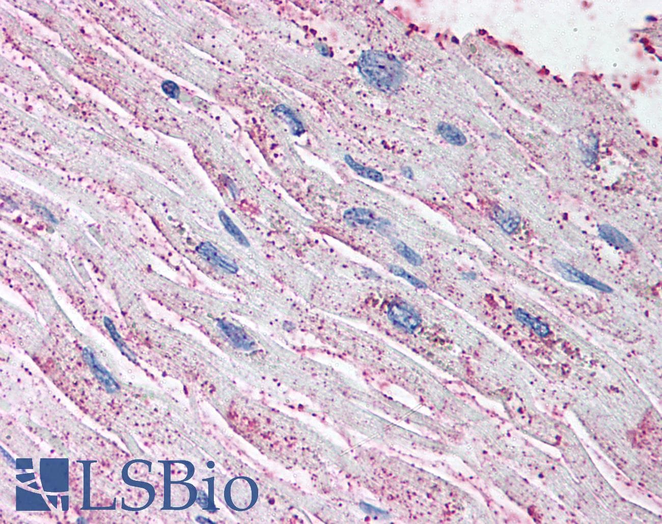IHC-plus™ EDNRA / Endothelin A Receptor Antibody (N-Terminus)