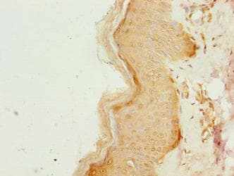 Polyclonal Rabbit anti-Human CCDC89 Antibody (IHC, WB)