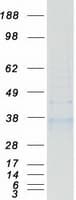 Human HSD11B1 / HSD11B Protein (Recombinant Myc-DDK (Flag))