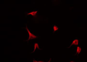 Polyclonal Rabbit anti-Human CDKN2C / p18 INK4c Antibody (IHC, IF, WB)