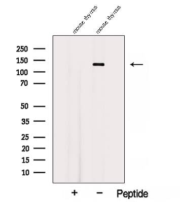 Polyclonal Rabbit anti-Human AFAP1L2 / XB130 Antibody (IF, WB)