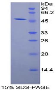 Human ADIPOR1/Adiponectin Receptor 1 Protein (Recombinant His-GST)