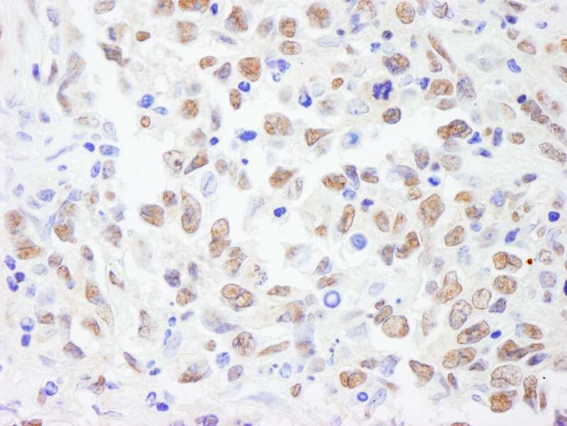 Polyclonal Rabbit anti-Human PRPF19 / PRP19 Antibody (aa25-75, IHC, WB)