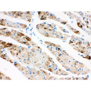 CPT1B Antibody (aa197-226)
