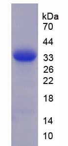 Human GRN / Granulin Protein (Recombinant His-S)