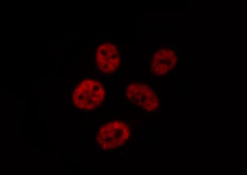 CHEK2 / CHK2 Antibody